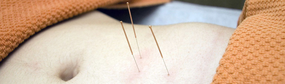 Accupuncture, Eastern Healing Arts in the Montgomery County, PA area